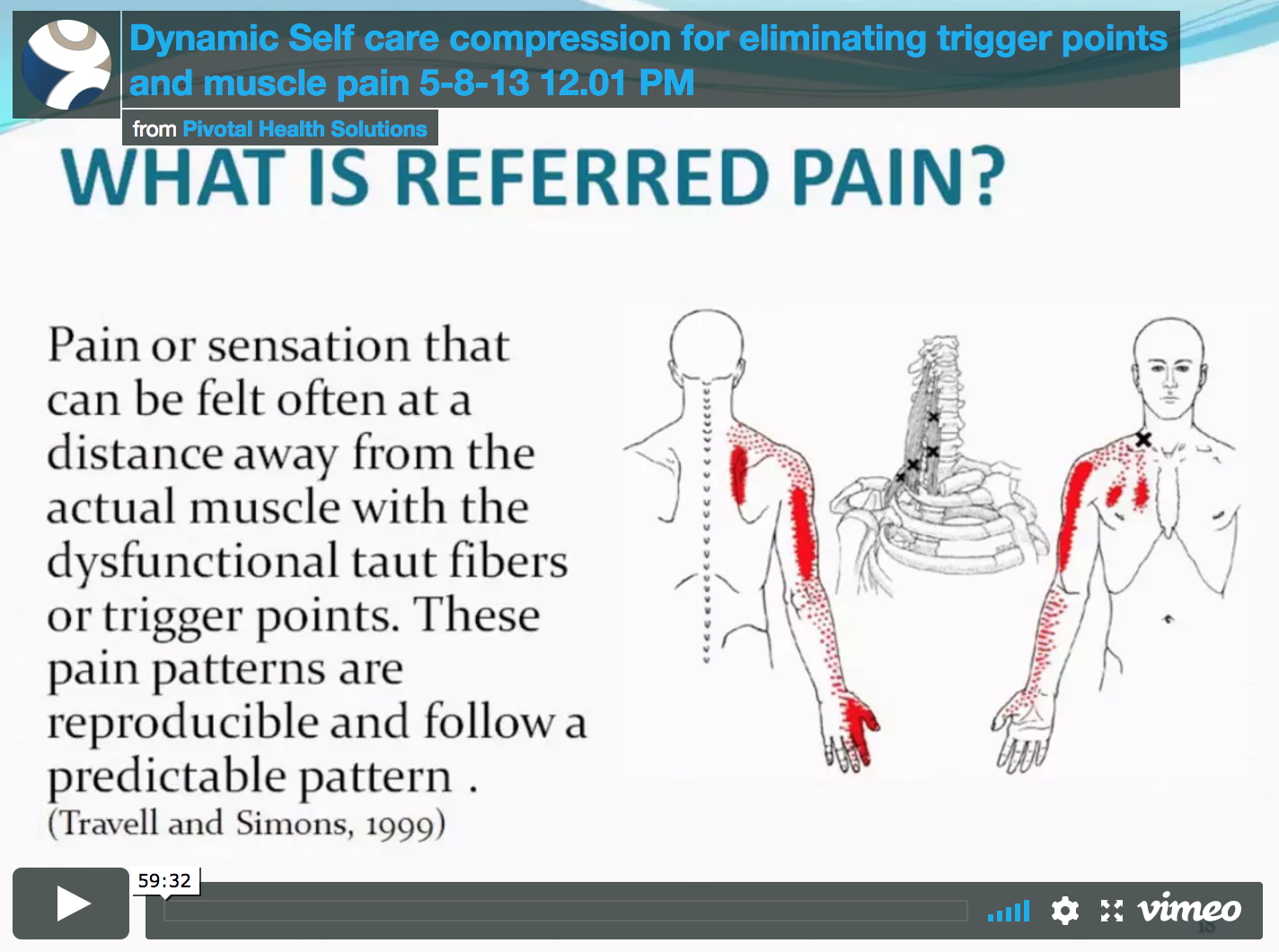 Trigger Points and Muscle Pain